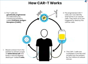 NexCAR19 CAR T